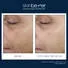 Skinbetter Science Even Tone Correcting Serum